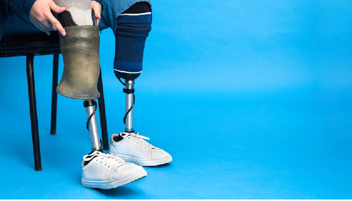 robotic knee replacement